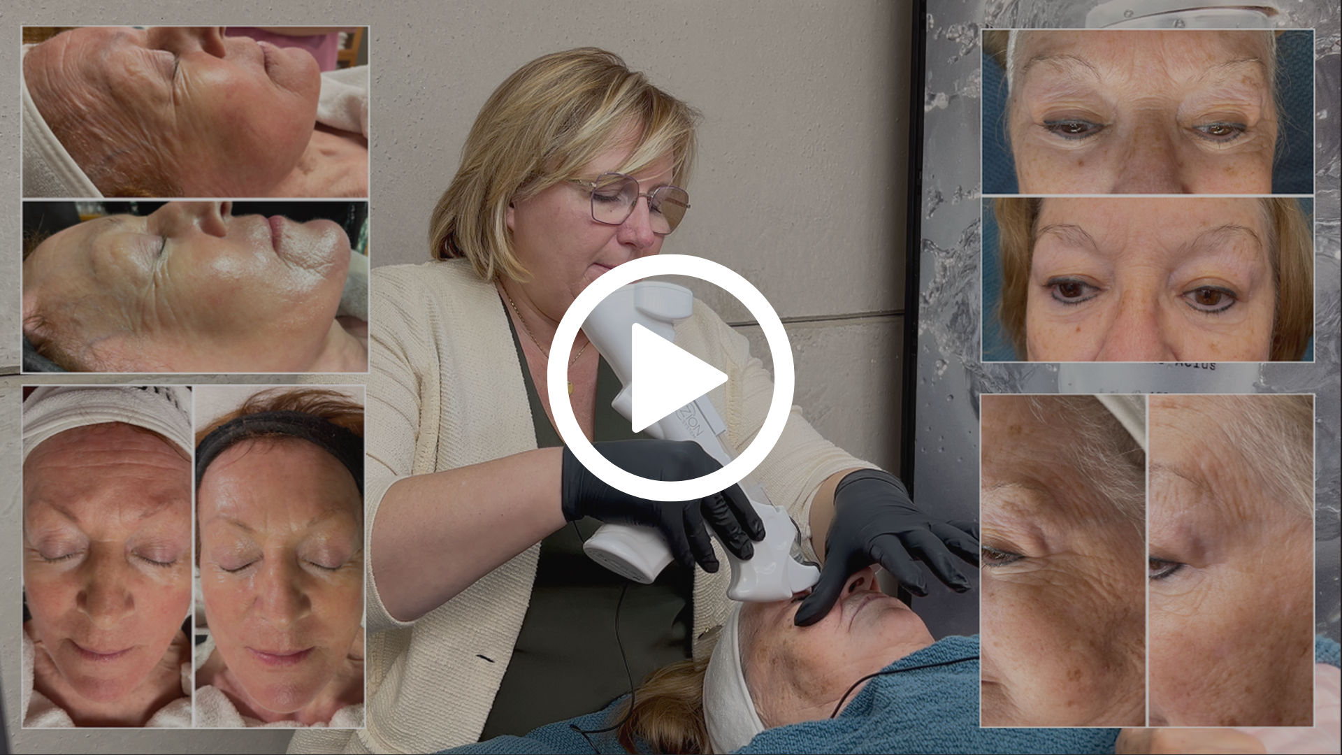 Infuzion System uitleg behandeling video