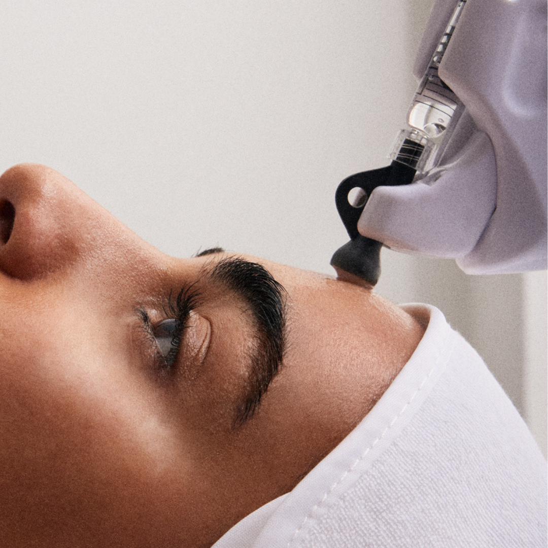 Bescherm ke huid met carbon fiber