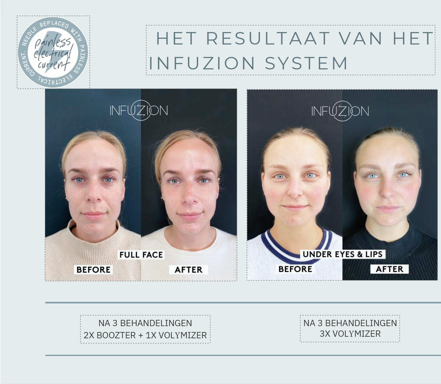 protocol Volymizer serum Infuzion System